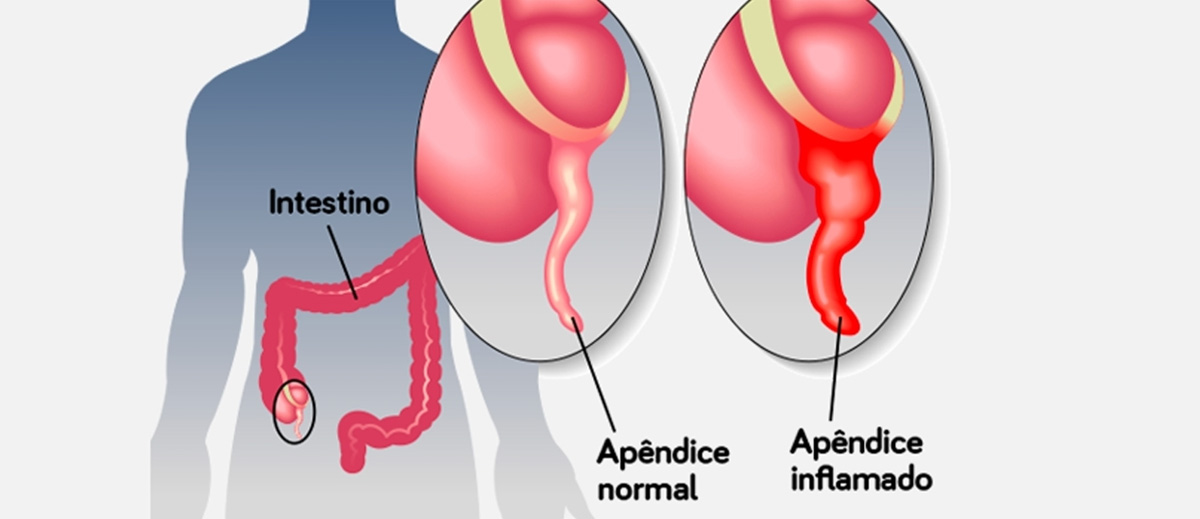 Instituto Laparo Cirurgia Geral Avançada Em Alfenas Mg